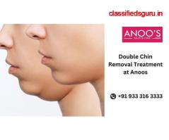 Double chin removal treatment at ANOOS