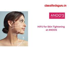 Advanced Hifu for Skin Tightening at ANOOS